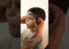 Burn treatment for Gaza children threatened by Israeli restrictions